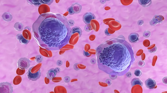 29/05/2023 - Evolução no tratamento das leucemias agudas aumenta as chances de cura